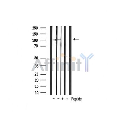HIF1A Antibody - Western blot analysis of extracts from various sample,using hif1a antibody.