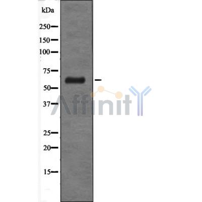 GABRD Antibody - Western blot analysis of extracts from HT-29 cells using GABRD antibody.