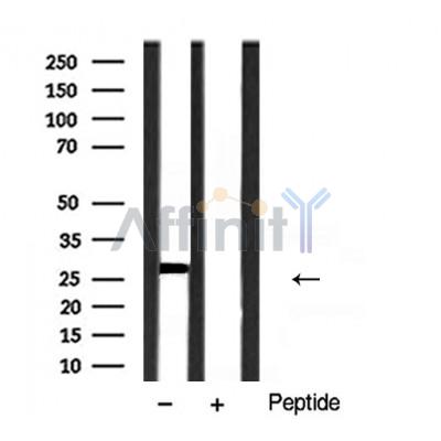 VEGFA Antibody - Western blot analysis of VEGF expression in rat spleen tissue sample.