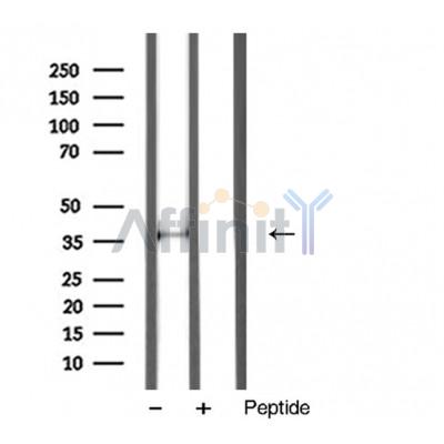 Annexin A1 Antibody - Western blot analysis of Annexin I Antibody expression in mouse liver tissue  lysates.
