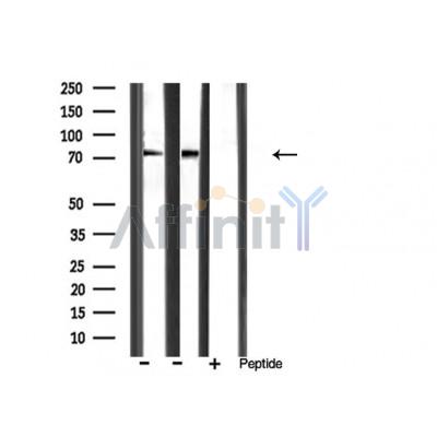 MMP9 Antibody - Western blot analysis of extracts from various sample,using MMP-9 Antibody.