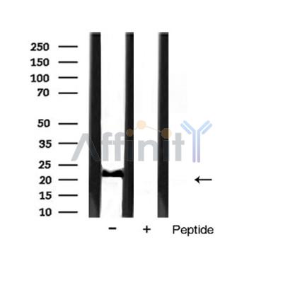 Bim Antibody - Western blot analysis of extracts from mouse muscle tissue,using BIM Antibody.
