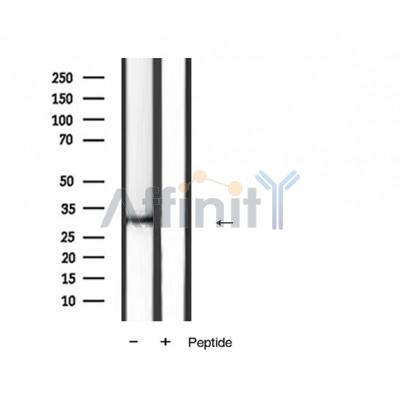 Fas Ligand Antibody - Western blot analysis of FAS ligand Antibody expression in mouse heart tissue lysates.