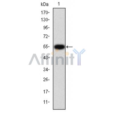 TGFBR1 Antibody - Western blot analysis of TGF β Receptor I expression in HepG2 cells.