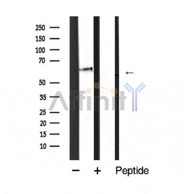 SQSTM1/p62 Antibody - Western blot analysis of extracts from mouse liver, using P62/SQSTM1 Antibody.