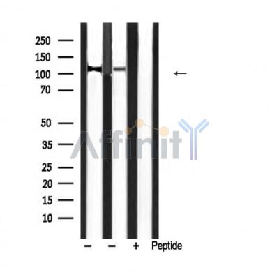 Phospho-MYPT1 (Thr853) Antibody - Western blot analysis of extracts from various smaple,using PMYPT1 (Phospho-Thr853) Antibody.