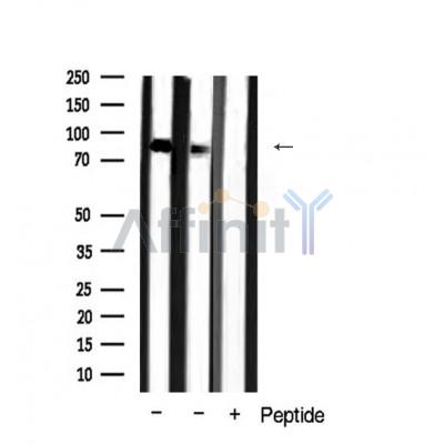 Catenin gamma Antibody - Western blot analysis of Catenin-γ expression in mouse tissue extract.