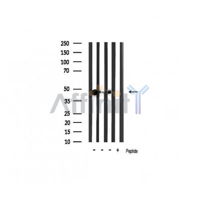 Phospho-GSK3 beta (Ser9) Antibody - Western blot analysis of extracts from various samples, using Phospho-GSK3 beta (Ser9) Antibody.