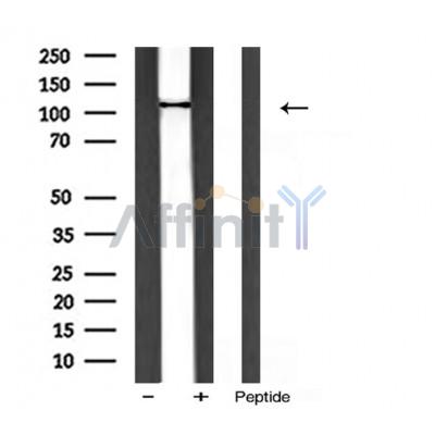 PI3 kinase P110 alpha Antibody - Western blot analysis of PI3 kinase P110α expression in rat liver.
