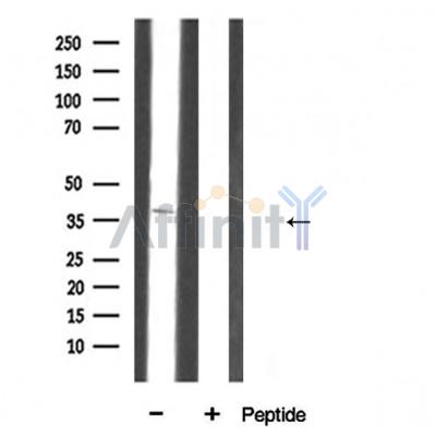 Annexin III Antibody - Western blot analysis of Annexin III Antibody expression in rat liver tissue lysates.