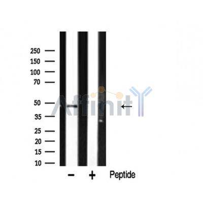 hnRNP H Antibody - Western blot analysis of hnRNP H expression in rat kidney lysate.