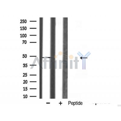 hnRNP H Antibody - Western blot analysis of hnRNP H expression in mouse lung lysate.