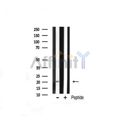 JM4 Antibody - Western blot analysis of JM4 expression in Rat liver lysate.