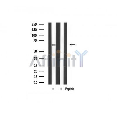 NF-kB p65 Antibody - Western blot analysis of NF-kappaB p65 expression in Rat spleen lysate.