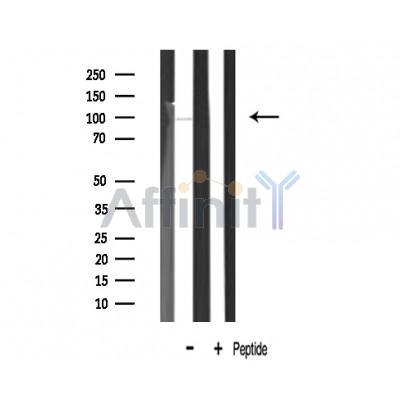 LTK Antibody - Western blot analysis of LTK expression in Mouse Brain lysate.
