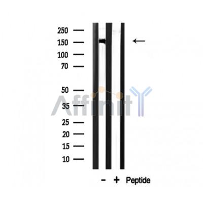 CAF1A Antibody - Western blot analysis of CAF1A  expression in Rat brain lysate.