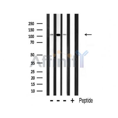 RBM26 Antibody - Western blot analysis of extracts from various samples, using RBM26 Antibody.