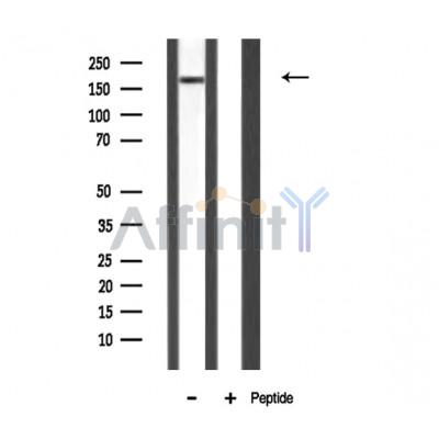 MAST2 Antibody - Western blot analysis of MAST2 expression in Rat spleen lysate.