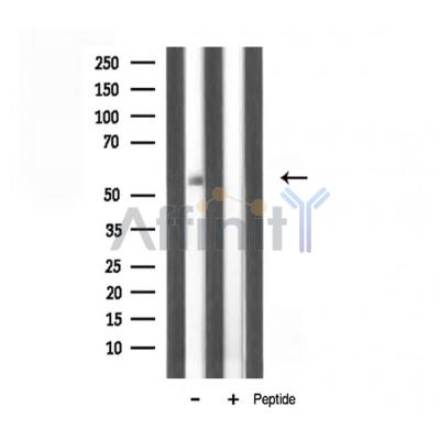 TBX22 Antibody - Western blot analysis of TBX22 expression in Mouse liver lysate.