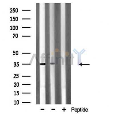 SLC25A31 Antibody - Western blot analysis of extracts from various samples, using SLC25A31 Antibody.