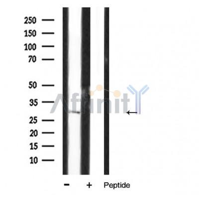 IL1 beta Antibody - Western blot analysis of Interleukin 1β expression in HUVEC lysates.