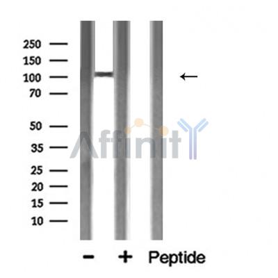 ACE2 Antibody - Western blot analysis of ACE2 expression in Mouse brain lysate.