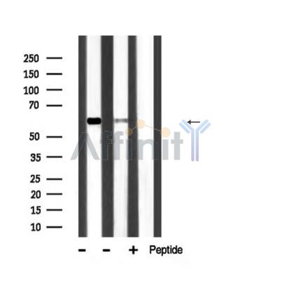 SQSTM1/p62 Antibody - Western blot analysis of extracts from various samples, using P62/SQSTM1 Antibody.