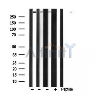 Factor VIII Antibody - Western blot analysis of extracts from various samples, using Factor VIII Antibody.