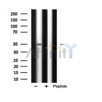 AKT3 Antibody - Western blot analysis of AKT3 expression in Mouse kidney lysate.