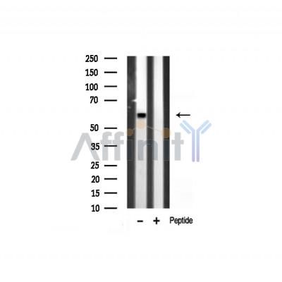 GAD1/2 Antibody - Western blot analysis of GAD1/2 expression in Rat heart lysate.