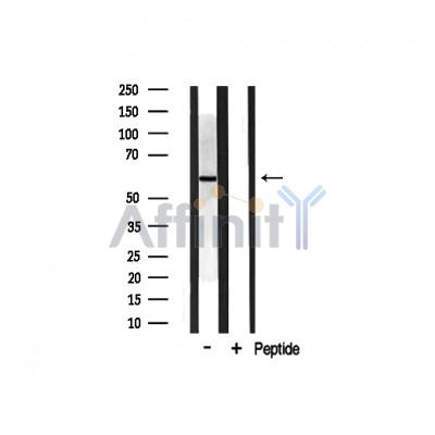 DOK3 Antibody - Western blot analysis on rat brain lysates using DOK3 Antibody.