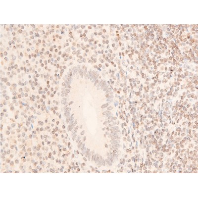 Phospho-JAK1 (Tyr1022)[Tyr1034] Antibody - AF2012 at 1/100 staining human appendiceal tissue sections by IHC-P.