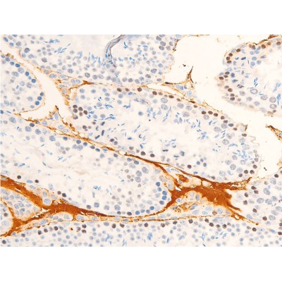 Phospho-JAK1 (Tyr1022)[Tyr1034] Antibody - AF2012 at 1/100 staining mouse testis tissue sections by IHC-P.