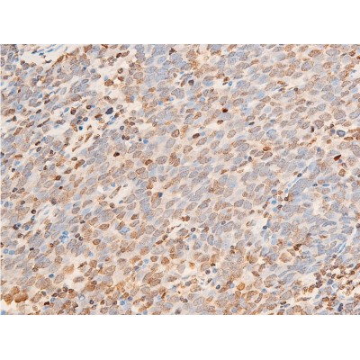 Phospho-JAK1 (Tyr1022)[Tyr1034] Antibody - AF2012 at 1/100 staining human seminoma tissue sections by IHC-P.
