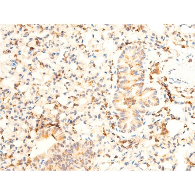Phospho-JAK1 (Tyr1022)[Tyr1034] Antibody - AF2012 at 1/100 staining mouse lung tissue sections by IHC-P.