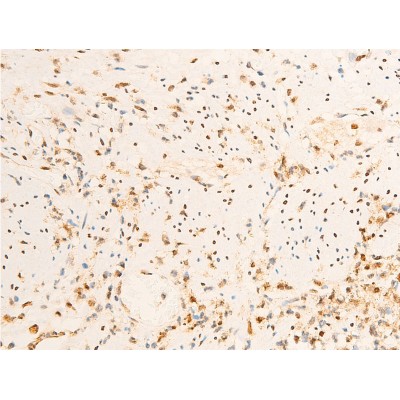 Phospho-JAK1 (Tyr1022)[Tyr1034] Antibody - AF2012 at 1/100 staining rat appendiceal tissue sections by IHC-P.
