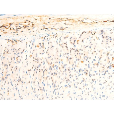 Phospho-JAK1 (Tyr1022)[Tyr1034] Antibody - AF2012 at 1/100 staining mouse intestinal tissue sections by IHC-P.