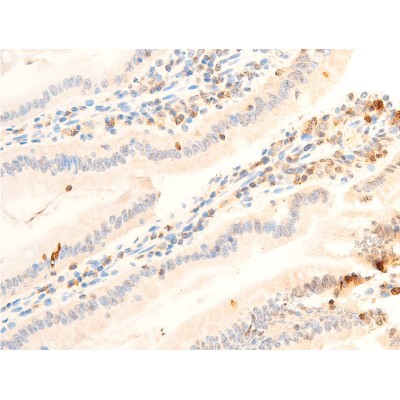 Phospho-JAK1 (Tyr1022)[Tyr1034] Antibody - AF2012 at 1/100 staining rat intestinal tissue sections by IHC-P.