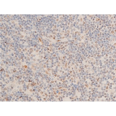 Phospho-Chk1 (Ser280) Antibody - AF2014 at 1/100 staining human appendiceal tissue sections by IHC-P.