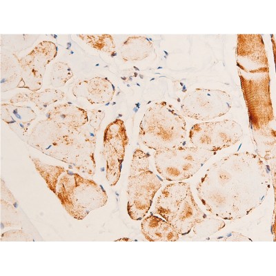 Phospho-Chk1 (Ser280) Antibody - AF2014 at 1/100 staining human heart tissue sections by IHC-P.
