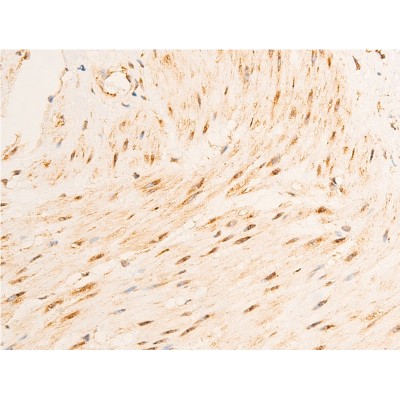 Phospho-GSK3 beta (Ser9) Antibody - AF2016 at 1/100 staining human gastric tissue sections by IHC-P.