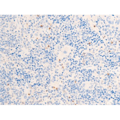 Phospho-Chk1 (Ser317) Antibody - AF3007 at 1/100 staining rat spleen tissue sections by IHC-P.