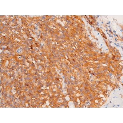 Phospho-Chk1 (Ser317) Antibody - AF3007 at 1/100 staining human lymphoid tissue sections by IHC-P.