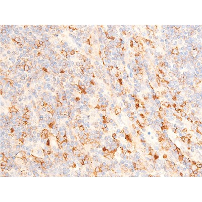 Phospho-Chk1 (Ser317) Antibody - AF3007 at 1/100 staining human appendiceal tissue sections by IHC-P.