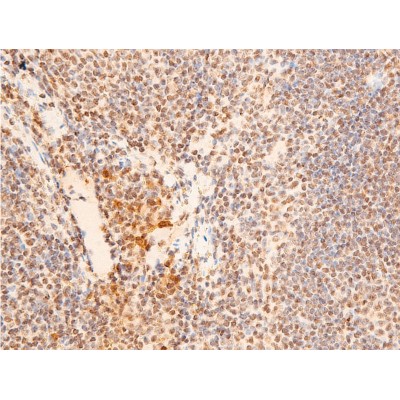 Phospho-Chk2 (Thr383) Antibody - AF3034 at 1/100 staining mouse spleen tissue sections by IHC-P.