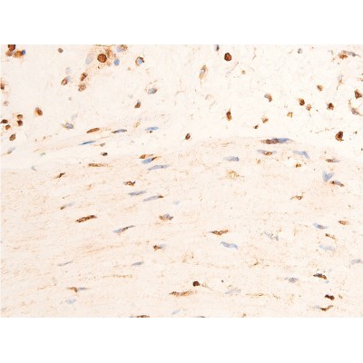 Phospho-Chk2 (Thr383) Antibody - AF3034 at 1/100 staining human gastric tissue sections by IHC-P.