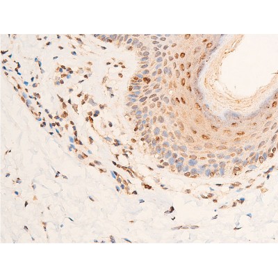Phospho-Chk2 (Thr383) Antibody - AF3034 at 1/100 staining human skin tissue sections by IHC-P.