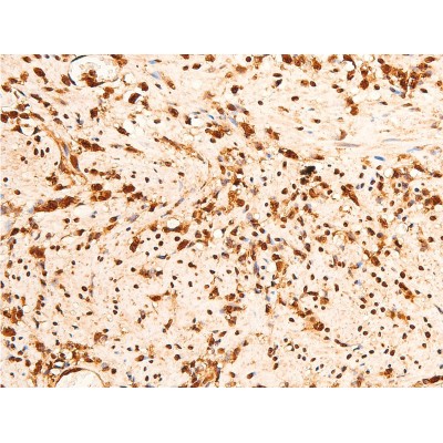 Phospho-Chk2 (Thr383) Antibody - AF3034 at 1/100 staining rat appendiceal tissue sections by IHC-P.