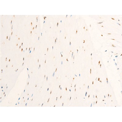 Phospho-c-Myc (Ser62) Antibody - AF3054 at 1/100 staining human heart tissue sections by IHC-P.