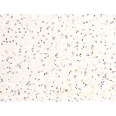 Phospho-c-Myc (Ser62) Antibody - AF3054 at 1/100 staining human liver tissue sections by IHC-P.